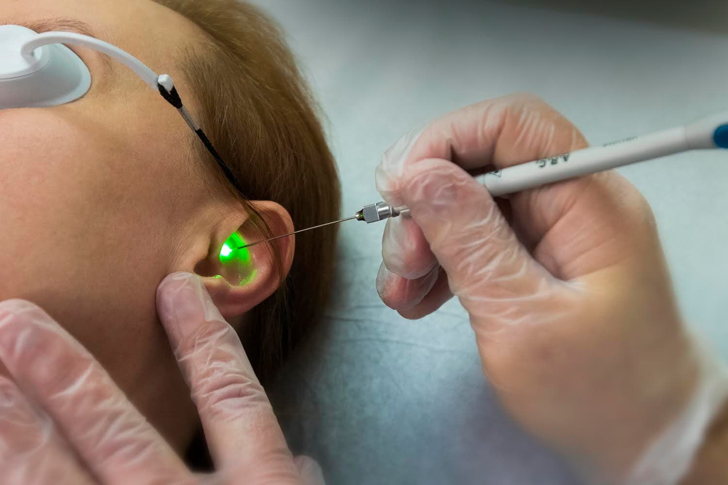 Advanced skin treatment procedure at CMSD